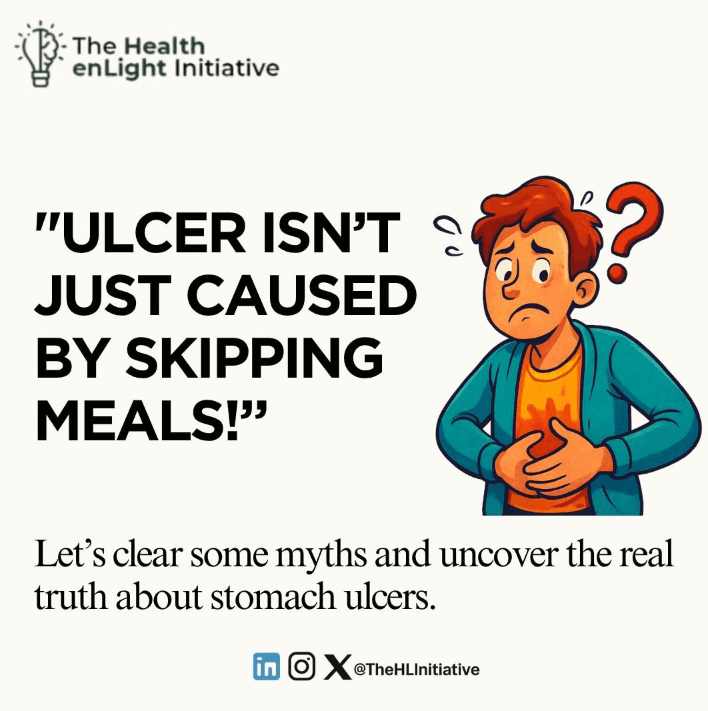 The Truth About Ulcers — What You Should Know